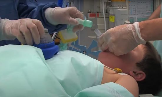 Use of the i-gel® supraglottic airway in paediatric surgery